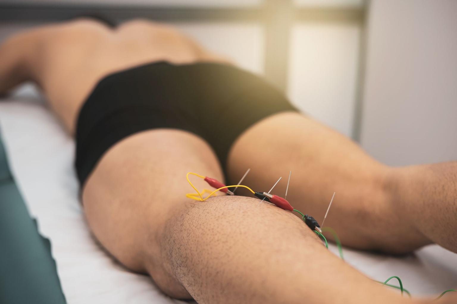 Dry Needling in Oklahoma City: Not Just for Athletes